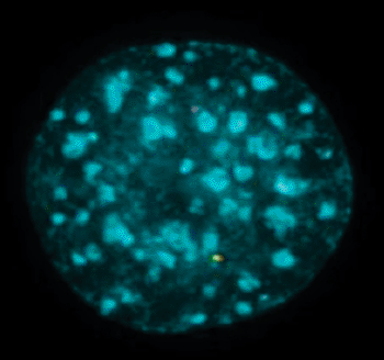 Image: In new research, scientists have directly observed events that lead to formation of a chromosome abnormality that is often found in cancer cells (Photo courtesy of National Cancer Institute [NCI] at NIH).